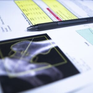 popello m2 thermal morbus bechterew stuhl mit sitzheizung medizinische forschung orthopaedie patienten bandscheibenvorfall 3 ergopoint